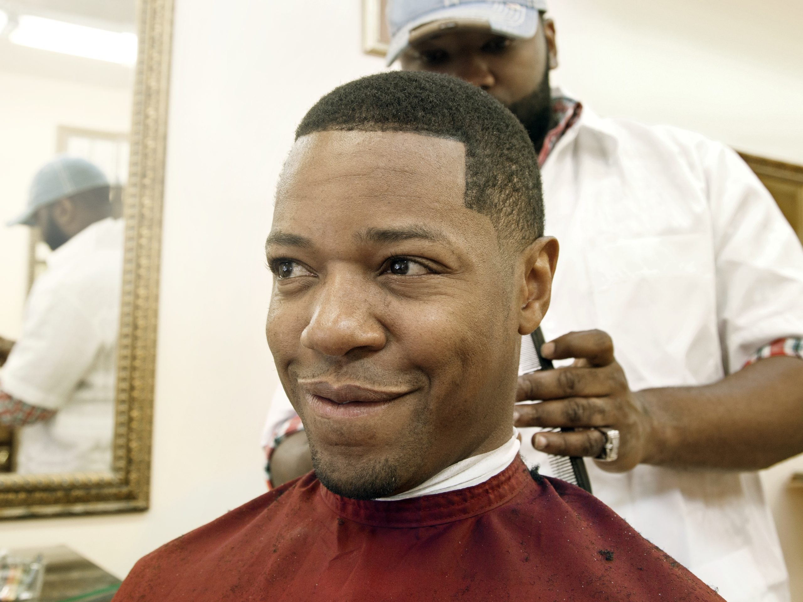How to Prevent a Receding Hairline– According To A Dermatologist