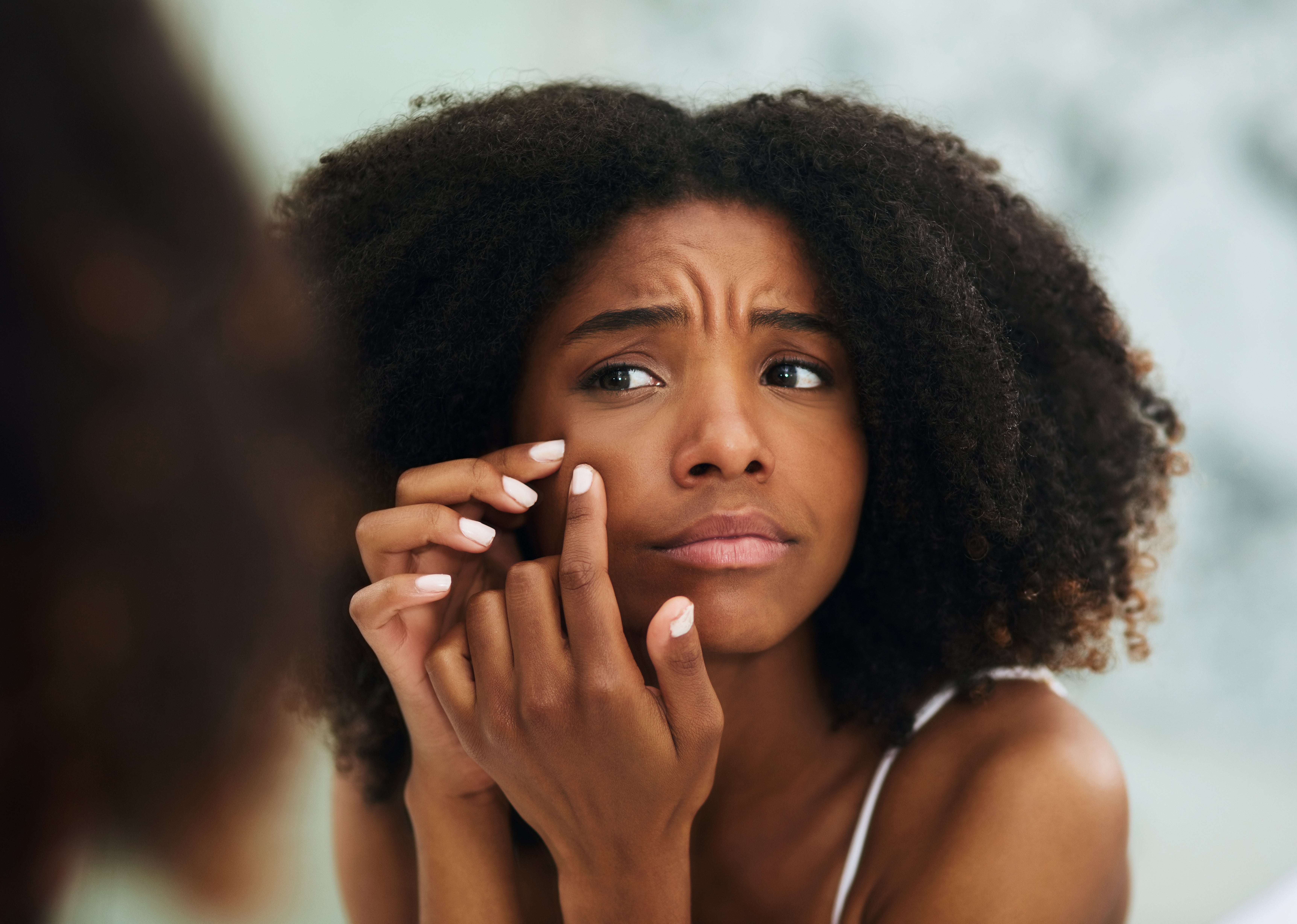 9 Serums Your Acne-Prone Skin Needs